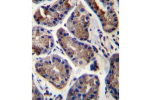 SLC9A2 Antibody immunohistochemistry analysis in formalin fixed and paraffin embedded human stomach tissue followed by peroxidase conjugation of the secondary antibody and DAB staining.