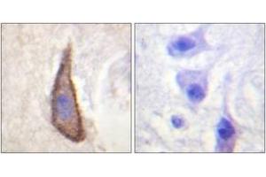 Immunohistochemistry analysis of paraffin-embedded human brain, using CD226/DNAM-1 (Phospho-Ser329) Antibody. (CD226 抗体  (pSer329))