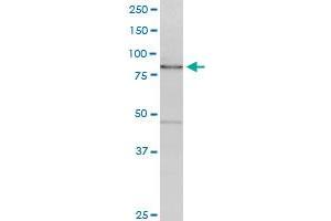 CAGE1 monoclonal antibody (M01), clone 3H8. (CAGE1 抗体  (AA 2-100))