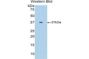 Western blot analysis of the recombinant protein. (CXCL13 抗体  (AA 22-109))