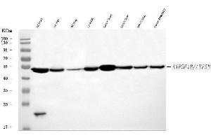 Western blot analysis of ATP5F1B using anti-ATP5F1B antibody (ABIN7599866). (Atp5f1b (AA 123-529) 抗体)