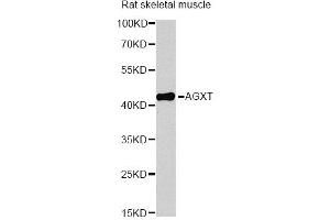 Western blot analysis of extracts of rat skeletal muscle, using AGXT antibody (ABIN6291533) at 1:1000 dilution. (AGXT 抗体)