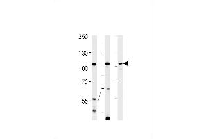 Western blot analysis in Hela，K562 cell line and rat spleen tissue lysates (35ug/lane). (TFIP11 抗体  (N-Term))