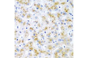 Immunohistochemistry of paraffin-embedded human liver injury using WNT2 antibody at dilution of 1:200 (40x lens). (WNT2 抗体)