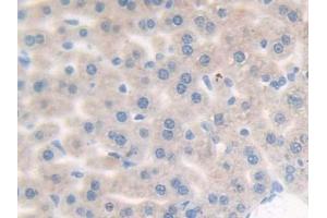 IHC-P analysis of Mouse Liver Tissue, with DAB staining. (Complement Factor B 抗体  (AA 474-590))