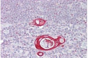 Anti-FAIM / FAIM1 antibody IHC staining of human thymus. (FAIM 抗体  (AA 35-84))