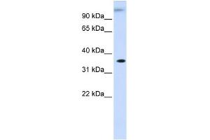 WB Suggested Anti-DHDH Antibody Titration: 0. (DHDH 抗体  (Middle Region))