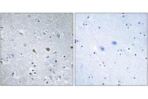 Immunohistochemistry analysis of paraffin-embedded human brain tissue, using Stathmin 1 (Ab-37) Antibody. (Stathmin 1 抗体  (AA 21-70))