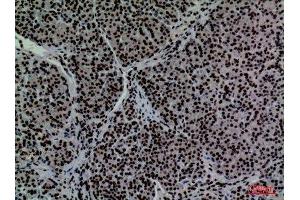 Immunohistochemistry (IHC) analysis of paraffin-embedded Human Pancreas, antibody was diluted at 1:100. (CD2 抗体  (N-Term))