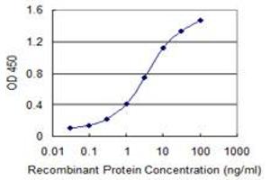 Detection limit for recombinant GST tagged LDB3 is 0. (LIM Domain Binding 3 Protein 抗体  (AA 1-283))