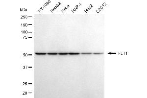 anti-Fms-Related tyrosine Kinase 1 (VEGFR1) (FLT1) antibody