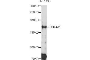 Western blot analysis of extracts of U-87 MG cells, using COL4A1 Antibody (ABIN5997482) at 1:3000 dilution. (COL4A1 抗体)