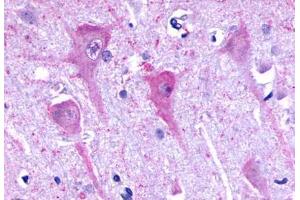 Anti-P2RY8 / P2Y8 antibody  ABIN1049223 IHC staining of human brain, neurons and glia. (P2RY8 抗体  (C-Term))