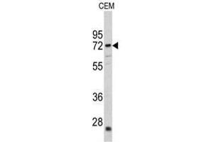 Image no. 1 for anti-Carnitine O-Acetyltransferase (CRAT) (N-Term) antibody (ABIN452873) (CRAT 抗体  (N-Term))