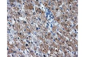 Immunohistochemical staining of paraffin-embedded liver tissue using anti-LEMD3mouse monoclonal antibody. (LEMD3 抗体)