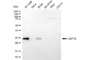 Western blotting analysis using GSTT2 antibody (ABIN7798759). (GSTT2 抗体)
