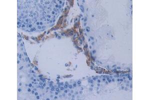 IHC-P analysis of Kidney tissue, with DAB staining. (METTL21C 抗体  (AA 1-248))