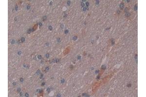 Immunohistochemistry (IHC) image for anti-Secreted phosphoprotein 1 (SPP1) (AA 18-314) antibody (ABIN7442486)