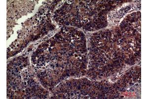 Immunohistochemistry (IHC) analysis of paraffin-embedded Human Lung, antibody was diluted at 1:100. (CD63 抗体  (Internal Region))
