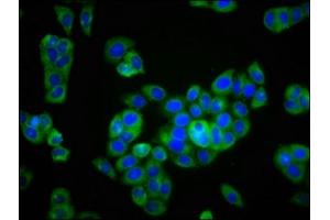 Immunofluorescence staining of PC-3 cells with ABIN7163936 at 1:166, counter-stained with DAPI. (KCNK9 抗体  (AA 250-362))