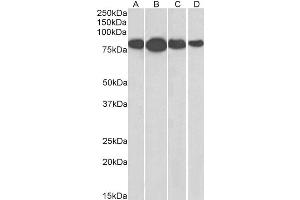 Radixin 抗体  (Internal Region)