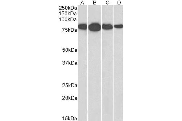 Radixin 抗体  (Internal Region)