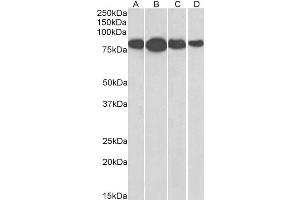 ABIN185665 (0. (Radixin 抗体  (Internal Region))