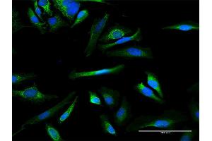 Immunofluorescence of purified MaxPab antibody to MMAB on HeLa cell. (MMAB 抗体  (AA 1-250))