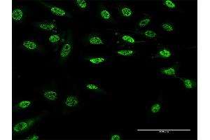 Immunofluorescence of monoclonal antibody to PAX9 on HeLa cell. (PAX9 抗体  (AA 205-300))