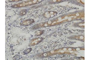 Immunoperoxidase of monoclonal antibody to MAP3K4 on formalin-fixed paraffin-embedded human small Intestine. (MAP3K4 抗体  (AA 1201-1300))