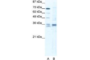 WB Suggested Anti-SOX12 Antibody Titration: 1. (SOX12 抗体  (C-Term))