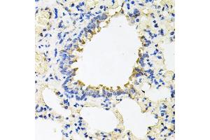 Immunohistochemistry of paraffin-embedded rat lung using CALU antibody (ABIN5973922) at dilution of 1/100 (40x lens). (CALU 抗体)