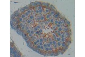 Immunohistochemistry (IHC) image for anti-ADAM Metallopeptidase Domain 17 (ADAM17) (AA 221-451) antibody (ABIN1862098)