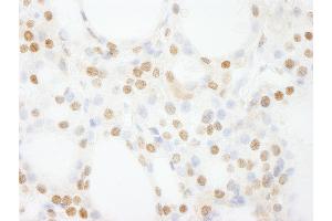 anti-General Transcription Factor IIIC, Polypeptide 4 (GTF3C4) (AA 1-50) antibody