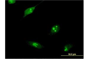 Immunofluorescence of monoclonal antibody to RPL10L on HeLa cell. (RPL10L 抗体  (AA 115-214))