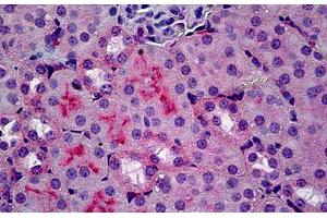 Mouse Kidney: Formalin-Fixed, Paraffin-Embedded (FFPE) (C5AR1 抗体)