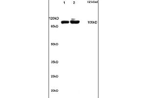 Lane 1: rat kidney lysates Lane 2: rat brain lysates probed with Anti alpha Actinin 4 Polyclonal Antibody, Unconjugated (ABIN733778) at 1:200 in 4 °C. (alpha Actinin 4 抗体)
