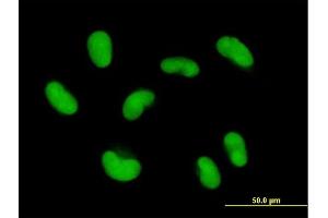 Immunofluorescence of purified MaxPab antibody to ZNF468 on HepG2 cell. (ZNF468 抗体  (AA 1-469))