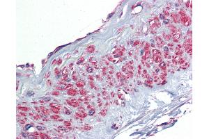 Anti-TGFBI antibody IHC of human vessel.