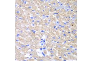 Immunohistochemistry of paraffin-embedded mouse heart using GPAM antibody (ABIN5973973) at dilution of 1/100 (40x lens). (GPAM 抗体)