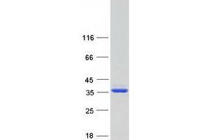 Western Blotting (WB) image for Hydroxypyruvate Isomerase (Putative) (HYI) (Transcript Variant 3) protein (Myc-DYKDDDDK Tag) (ABIN2723150)