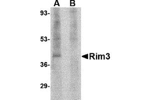 Western Blotting (WB) image for anti-Regulating Synaptic Membrane Exocytosis 3 (RIMS3) (N-Term) antibody (ABIN1031542) (RIMS3 抗体  (N-Term))