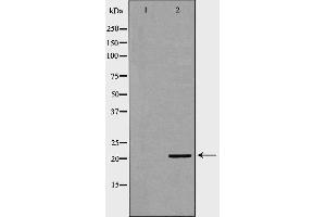 Western blot analysis of brain  lysate using KRAS antibody. (K-RAS 抗体  (C-Term))