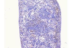 IHC analysis of PCDH15 using anti-PCDH15 antibody (ABIN6719362).