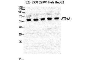 Western Blot (WB) analysis of specific cells using ATP5A Polyclonal Antibody.
