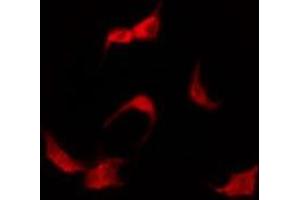 Immunofluorescence (fixed cells) (IF/ICC) image for anti-Solute Carrier Family 16 (Monocarboxylic Acid Transporters), Member 3 (SLC16A3) (Internal Region) antibody (ABIN6256944)