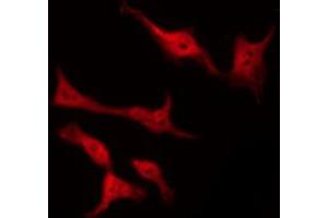 Immunofluorescence (fixed cells) (IF/ICC) image for anti-Rac GTPase Activating Protein 1 (RACGAP1) (pSer387) antibody (ABIN6255287)