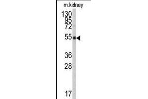 Western Blotting (WB) image for anti-Aldehyde Dehydrogenase 9 Family, Member A1 (ALDH9A1) (AA 4-34), (N-Term) antibody (ABIN6242161)