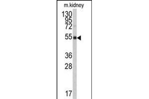 Western blot analysis of anti-ALDH9A1 Antibody (N-term) (ABIN6242161 and ABIN6579017) in mouse kidney tissue lysates (35 μg/lane). (ALDH9A1 抗体  (N-Term))
