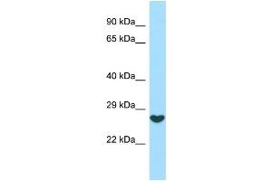 WB Suggested Anti-FGF16 Antibody Titration: 1. (FGF16 抗体  (C-Term))